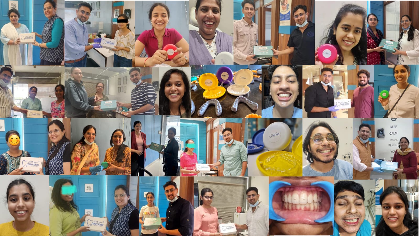 3D printed dental models used for aligner planning