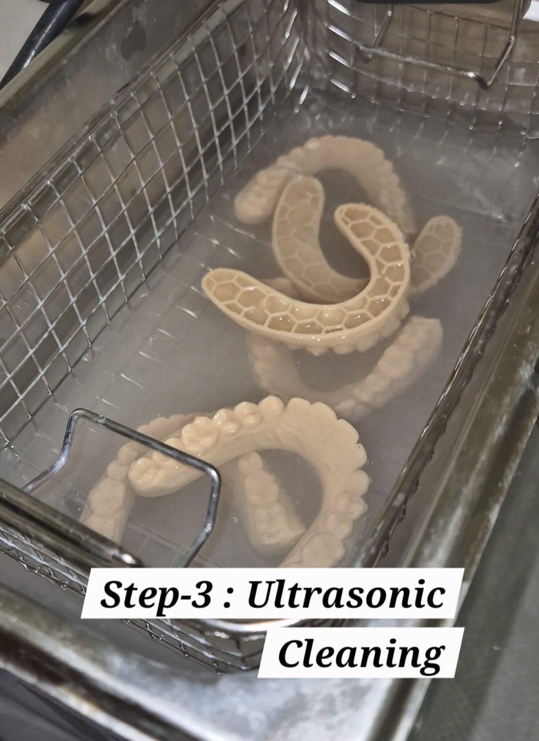 Dental impression models for custom aligners