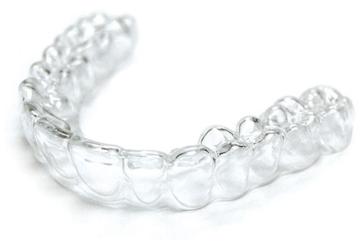 Intraoral 3D scan used to plan Comfy Aligns treatment